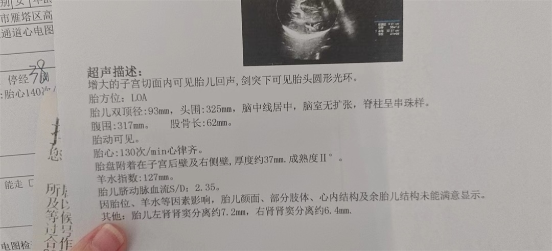 检查报告显示孕周不符。