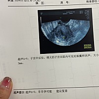 上周六检查早早孕，说太小了，过一星期再去b超医生，说子宫壁薄不能打麻药，只能药➕清，药好像吃的是米...