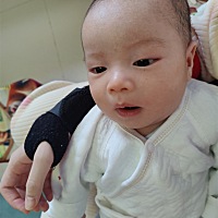 湿疹真的太难治了！两个月都没好，现在终于开始有成效了，是奶香奶香的小宝宝了！