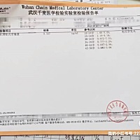 结果出来了 犹如晴天霹雳  今天去拿医院体检报告 但是看到这个结果 为什么老天爷要这样对我 辛辛苦苦跟...