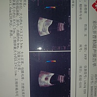 子宫有没有胎儿
