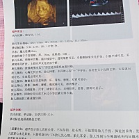 希望大家看到了我的彩超像个小棉袄还是像小王子，谢谢