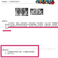 我的子宫有问题