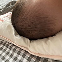 为什么快11个月了才这点头发呀？