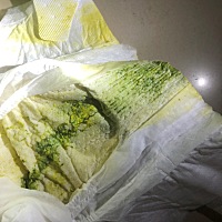 孩子拉稀绿便