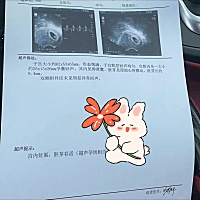 稳定了。🙈传各位集美胎心胎芽 。