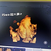 四维拍了九次还只拍到了侧脸，一个姐妹帮我做了张图，满足了我的好奇心 大家一起讨论下到底像不像！