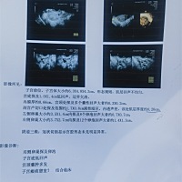 今天做了备孕检查，前三胎都是剖腹产，现在刀口最薄地方0.26cm，不知道能不能备孕第四胎