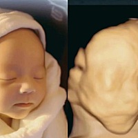 找人帮忙用四维彩超做的宝宝彩色照片 可能对于别人来说有啥呀 但是对于妈妈来说 能提前见一见宝宝真的好...