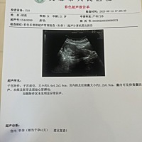 嘎嘎嘎 有没有小孕妇推荐的玩具