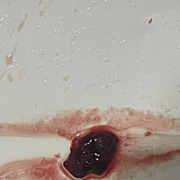 姨妈推迟9天，来姨妈排出的，这是什么在线等急