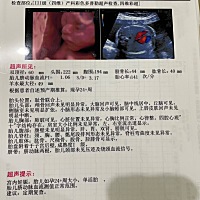 四维过了，好奇是穿粉色还是蓝色，有没有会看的宝妈呢？帮我看一下，谢谢🙏