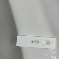 求助一下 这是有了吗？