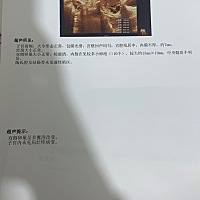 今年两次的检查结果，想要个孩子太难了，一个说怀不了要激素治疗，一个说例假来完去检查，心好累，备孕...