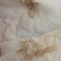姨妈过后10天流了咖啡色分泌物怎么回事啊？？