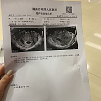 有专业人士能帮忙看看吗