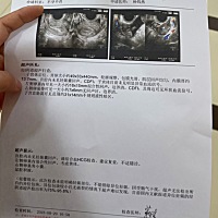 有一样经历的吗，有姐妹帮我解一下困惑吗