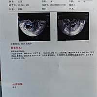 男孩？女孩？帮忙看下