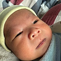 请问 吃喝拉撒都是正常的就是嘴色皮乌的啥子原因