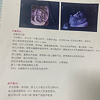 有会看男女的大神嘛？麻烦帮我看看