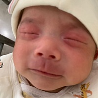 用广角扩开器检查宝宝眼睛，宝宝哭的撕心裂肺！好后悔去检查！幸好检查出来没问题！