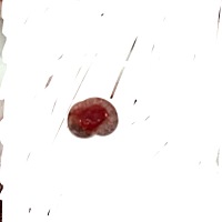 姐妹们，姨妈期间流出来这个东西，这是什么？和肉皮一样的东西