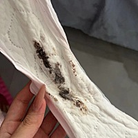 月经刚走和对象同房套破了吃药了，刚到排卵期流这个是什么情况
