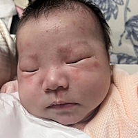 宝宝脸上是怎么了