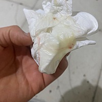 以前虽然白带增多但是没有发黄，还带血的，就这样持续了一个星期，
