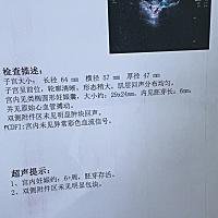 刚刚的B超单，都说椭圆形是女孩，还有机会翻盘吗，想儿女双全，为什么生儿子那么难………………
