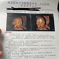 我家的三宝
