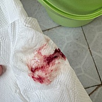 非经期出血….我是不是要死了…