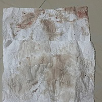 大姨妈延迟一星期了，验孕纸测了白板，然后感觉这个也不是很像来姨妈，有姐妹知道这是什么情况吗？