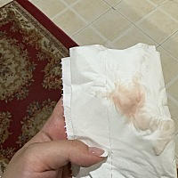 排卵期运动完出血这样正常吗姐们没