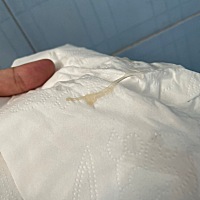 今天喝了中药去湿气的，上个大便，小便，擦到有白带，这个颜色，应该没有问题吧，平时不怎么有白带很少...