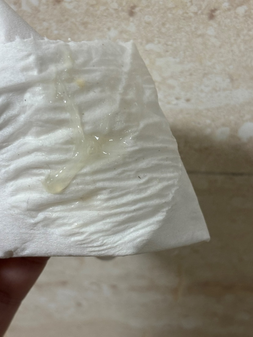 果冻似的白带 分不清是不是排卵期啦