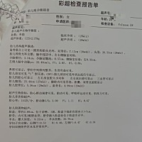 北京刘总的宝宝四维彩超一切正常 ​3个月后就可以和小公主见面啦[愉快][愉快][愉快]