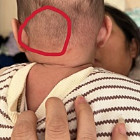 有人知道这里鼓起来是什么原因吗？