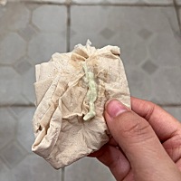 这是咋了呀 下面还瘙痒