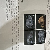 吃氨甲环酸谷胱甘肽怀孕有没有生下来姐妹呀，我吃了这两种药吃了三个月怀上了心跳都有了好怕这个宝宝不健康