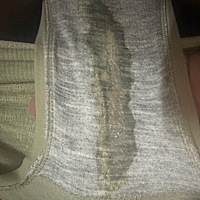 求助，我这个是什么霉菌吗，还是