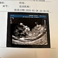 姐妹们快帮我看看蓝粉，老大是哥哥，这是二胎，求看！