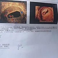 有宫腔积液问题不大吧？