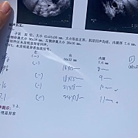 我一般都是17 8天左右排卵  现在15天都24✖️18了     到排卵日都小三十了  这样的卵泡还有机会吗