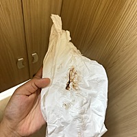 姐姐们 看看我这是咋了