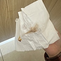 我又开始焦虑了。谁能告诉我这到底是怎么了呀啊