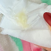 家人们这正常不 是不是属于黄绿色了