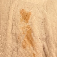 孕早期流这个分泌物正常？（这个是15号检查的）