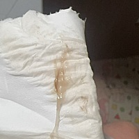 1月7号结束月经，1月17日、18日、20日均同房，19日就感觉小肚子疼（像快来大姨妈一样）并伴随腰酸很疲倦...