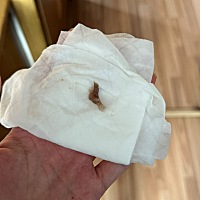 为啥同房后就会有这种黑色像果冻状一样的白带